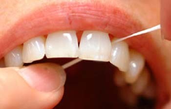 پلاک دندانی