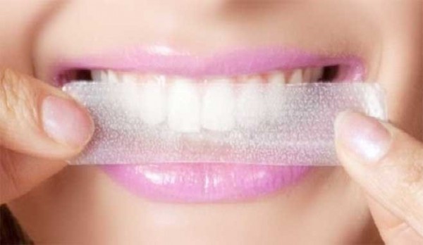روش‌های سفید کردن دندان