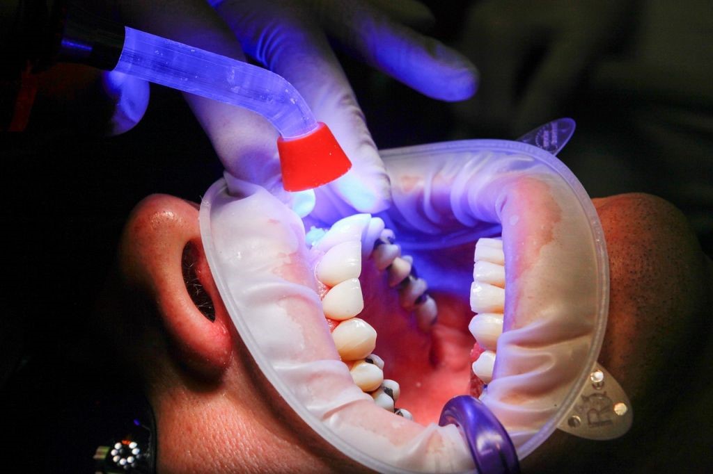 کاهش حساسیت پس از بلیچینگ دندان