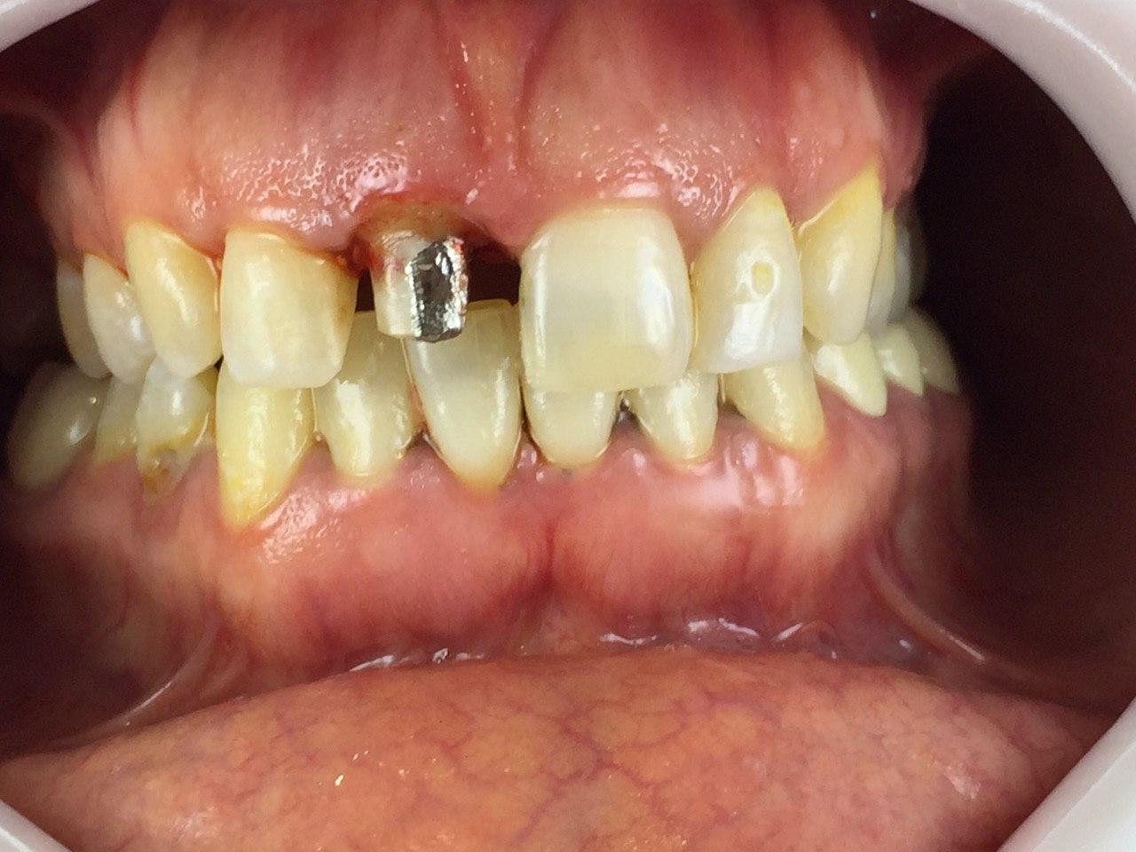 ترمیم و بازسازی دندان