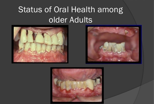 مراقبت دهانی دندانی برای سالمندان