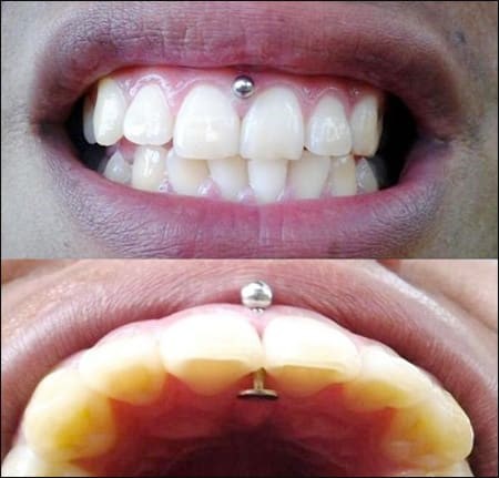 مضرات پیرسینگ ناحیه دهان