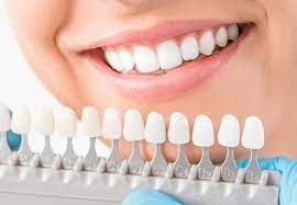 روکش دندانی یک روزه یا فوری