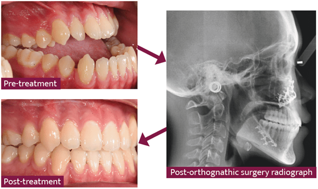 خطرات جراحی فک کدامند؟