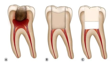 چه زمانی به دندانپزشک مراجعه کنیم؟